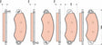 Brake Pad Set, Disc Brake GDB1744 - TRW