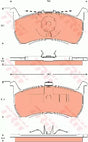 Brake Pad Set, Disc Brake GDB7520 - TRW