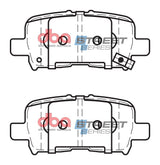 Ss Street Series Brake Pads Honda Acura & Mdx 2001-2014 Rear DB1440SS - DBA