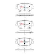 Ss Street Series Brake Pads Genesis GV80 08/2020 On Rear DB15142SS - DBA