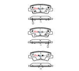 Ssev Street Series Brake Pads Hyundai Ioniq/Kona/Kia Niro 2017 On Rear DB2076SSEV - DBA | Universal Auto Spares
