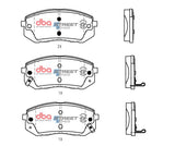 Ssev Street Series Brake Pads Hyundai Kona 2018 On Front DB2174SSEV - DBA | Universal Auto Spares