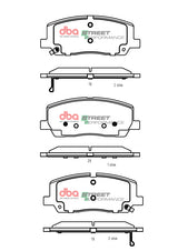 Sp Performance Brake Pads Genesis GV80 Suitable For Vehicles With 19\ Wheels (360MM Brake Rear DB2756SP - DBA | Universal Auto Spares